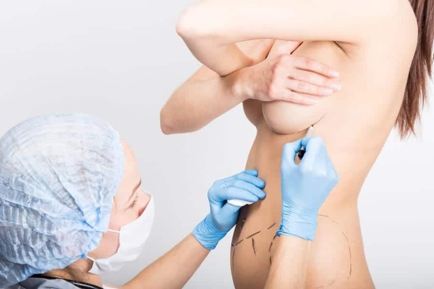 Breast Lift Surgery: Elevating Confidence and Revitalizing Feminine Beauty