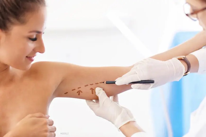 Empowered Beauty: The Magic of Arm Lift Procedures