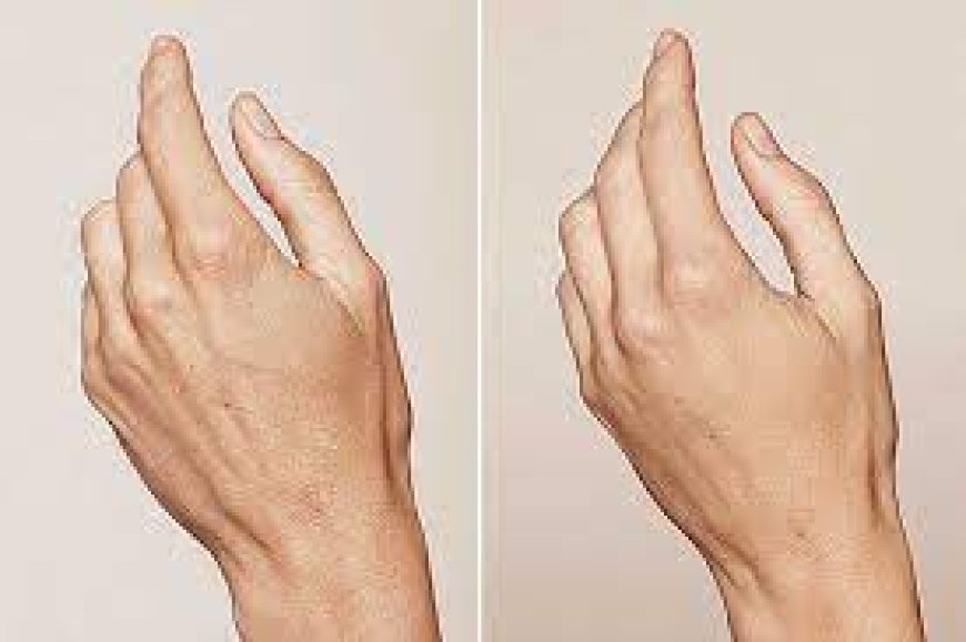 Reclaim Your Youthful Glow: Hand Rejuvenation Treatments