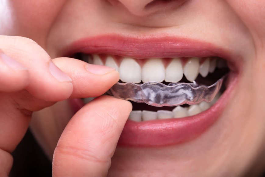 The Benefits of Clear Aligners for People with Disabilities or Special Needs