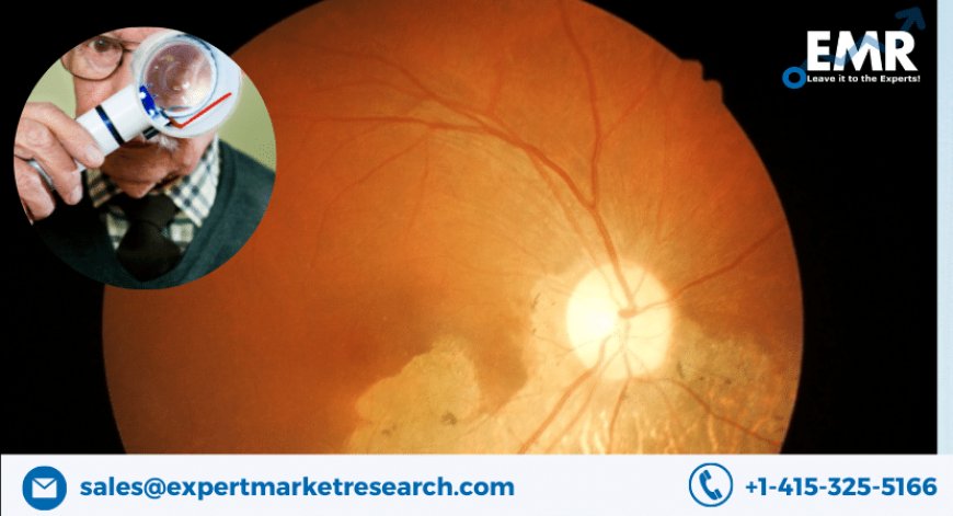 Global Age-Related Macular Degeneration (AMD) Market Share, Size, Growth, Outlook, Report and Forecast Period Of 2023-2028