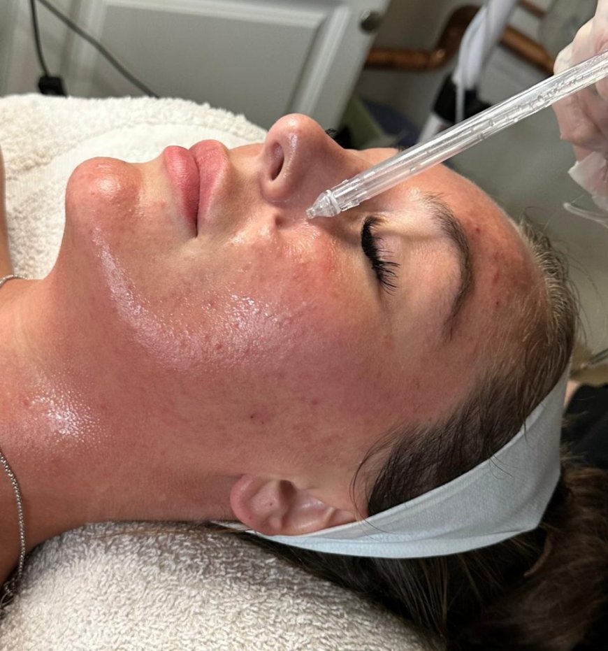 Unlocking Radiant Beauty: The Power of JetPeel Facials and Lash Lifts in Boston