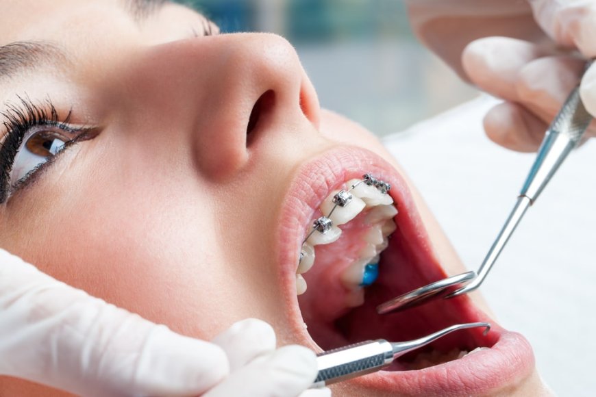 Achieve Your Perfect Smile: The Best Orthodontics Clinic & Dentist in Dubai