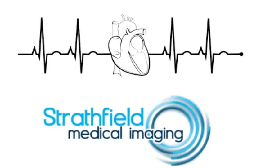 CT Angiography