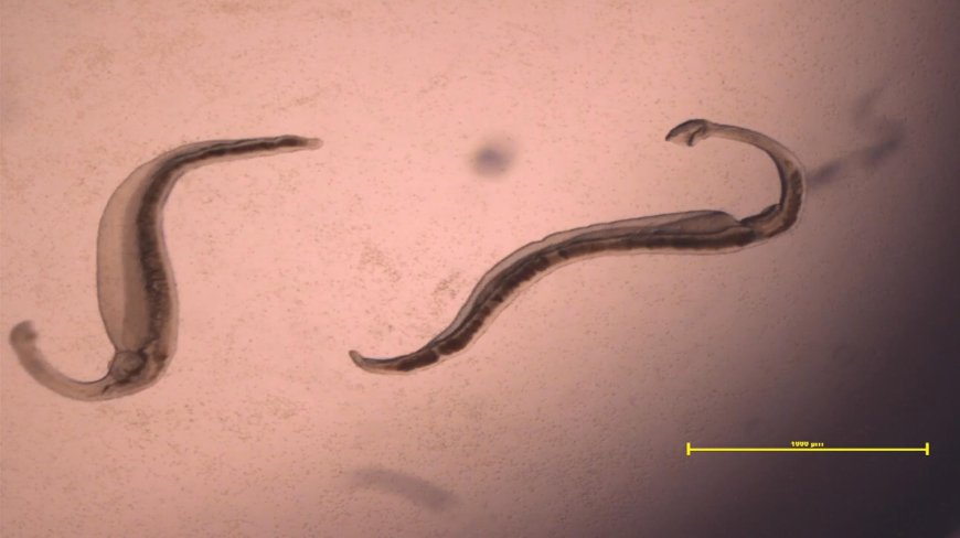Understanding Schistosomiasis: Causes, Symptoms, and Treatment Options