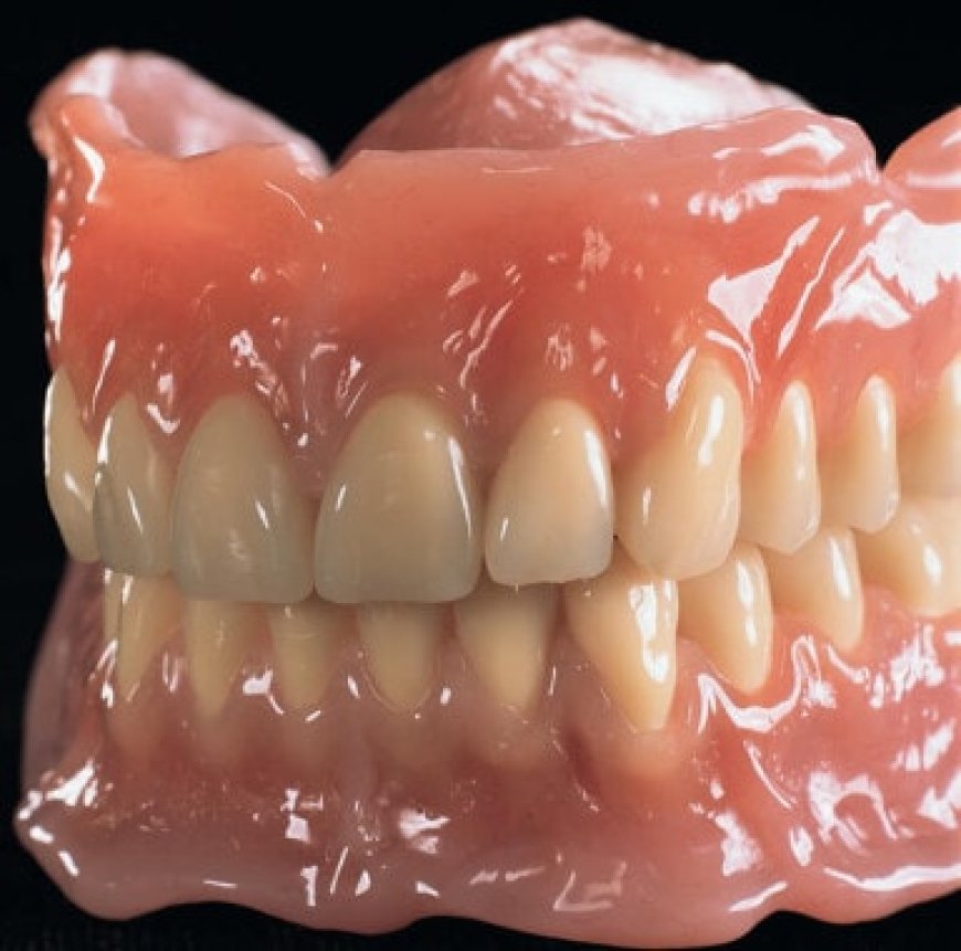 Why Complete Dentures Are Good?