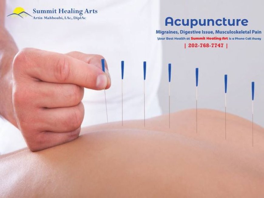 Exploring the Benefits of Acupuncture: Finding the Best Options Near Me