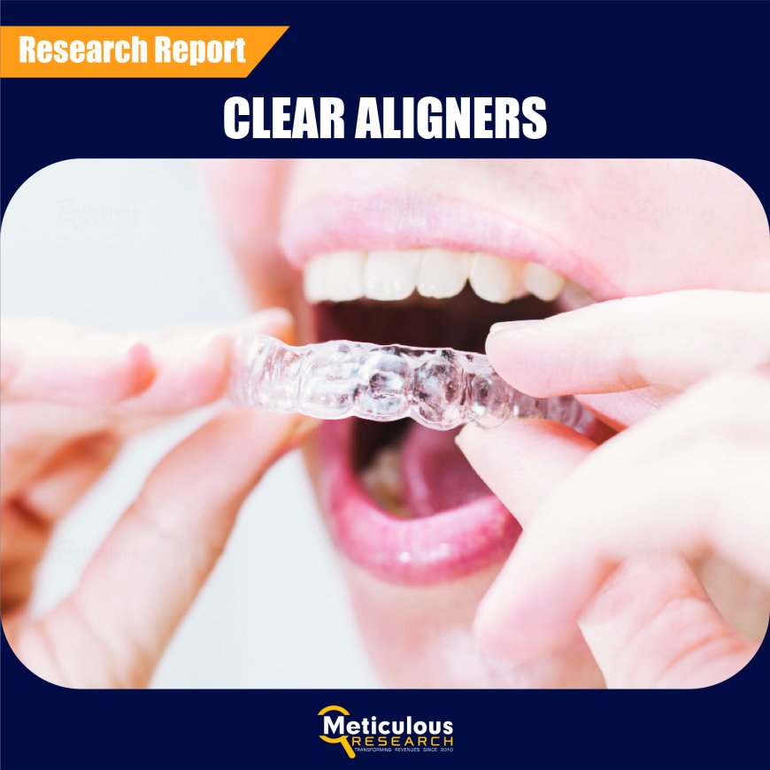 Clear Aligners Market to be worth $18.8 Billion by 2030