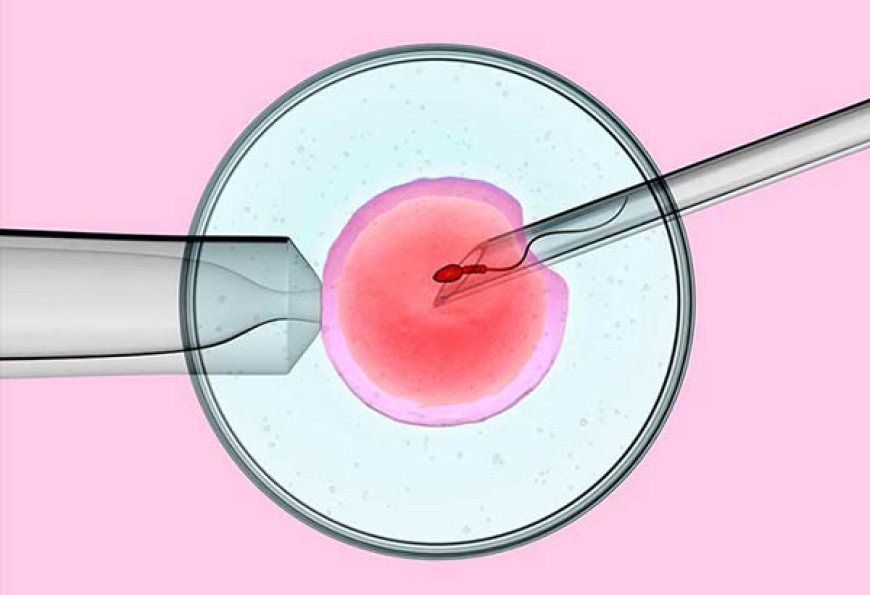Intracytoplasmic Sperm Injection (ICSI): Unraveling the Miracle of Assisted Reproduction