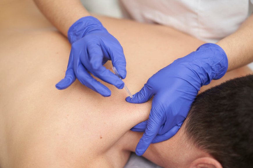 Exploring Dry Needling for Chronic Pain in NYC: Where to Go and What to Know