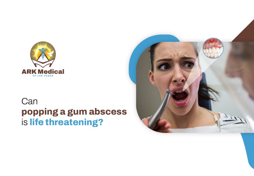 Can Popping a Gum Abscess Be Life-Threatening?
