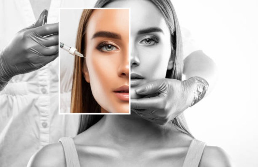 The Art of Filler: Enhancing Your Features with Precision and Expertise