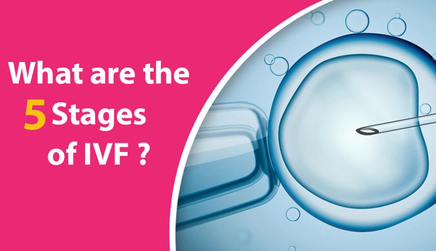 Understanding the 5 Stages of IVF: A Comprehensive Guide