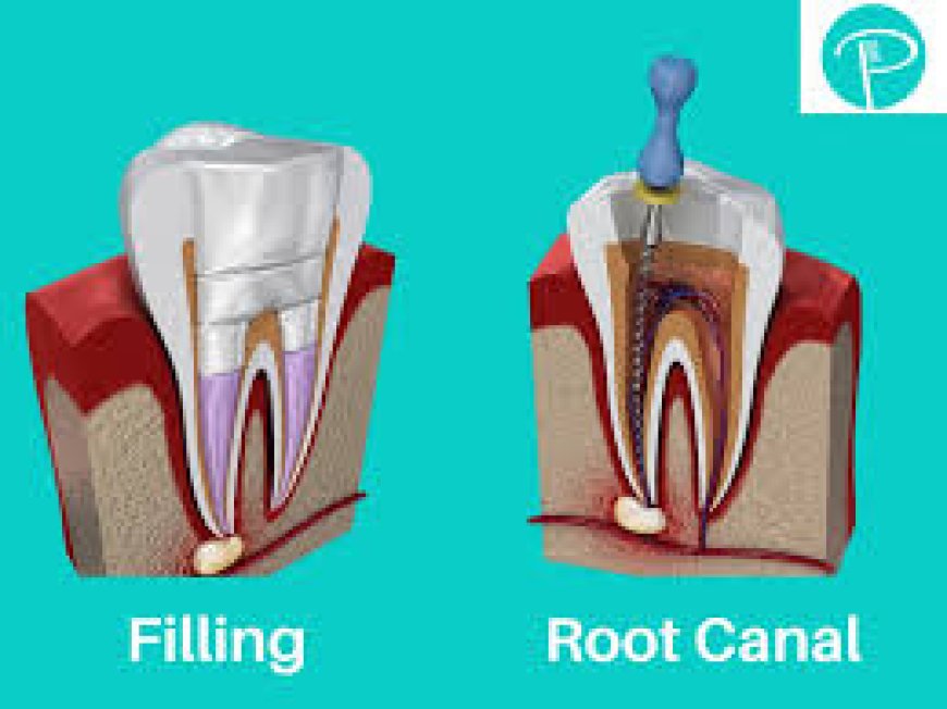 Root canal dentist in dindoshi