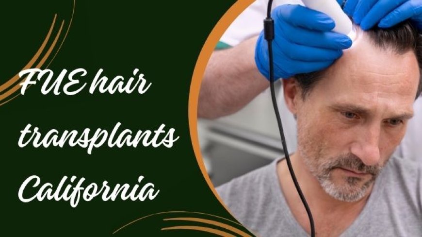 Who Can Benefit from Hair Transplant California?