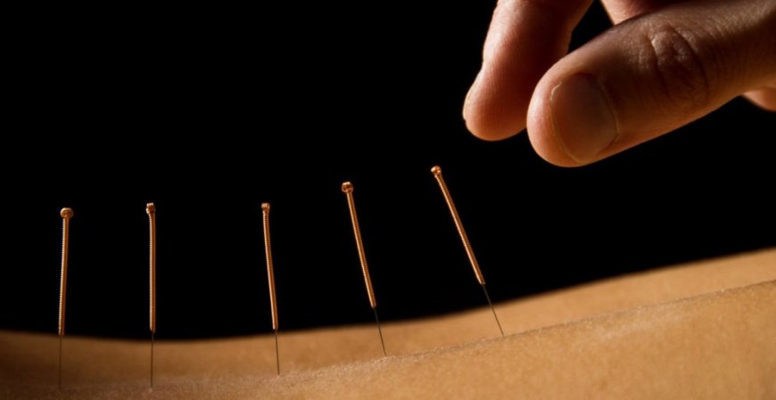 Unlocking Wellness: Exploring Acupuncture in Washington DC