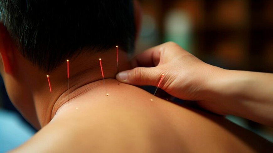 7 Effective Acupuncture Techniques for Chronic Pain Relief