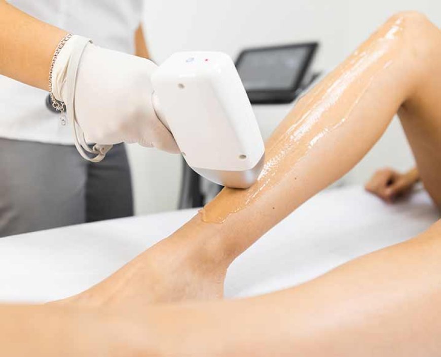 Laser Hair Removal: Is It Worth It?
