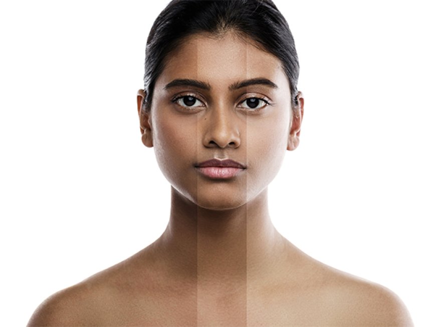 Understanding Melanin and Its Overproduction by Dr Hera's Skin & Hair Clinic