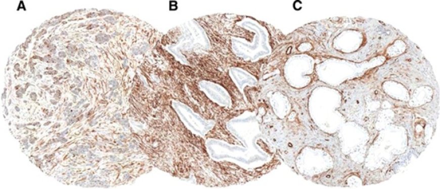 CD BioSciences Announces Cytoskeleton-Targeted Tumor Marker Development Service for Cancer Diagnosis   