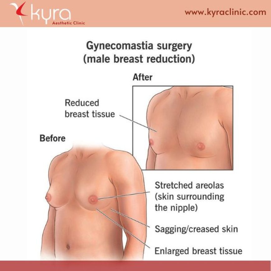 Gynecomastia surgery Punjab