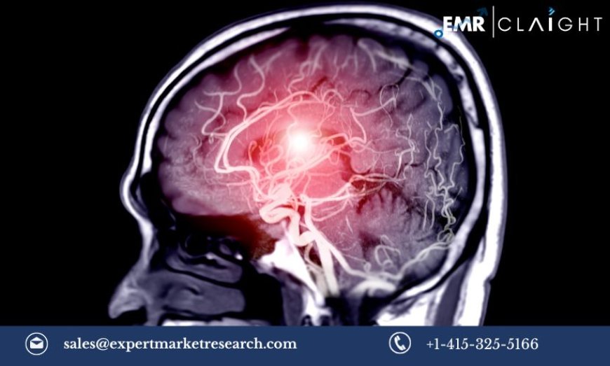 North America Intracranial Aneurysm Market Size, Share, Growth, Trends & Report 2024-2032