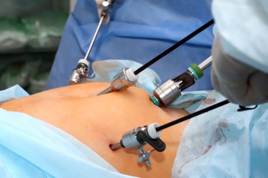 Discover Excellence in Laparoscopic Hysterectomy: Experience Top-tier Care in South Delhi