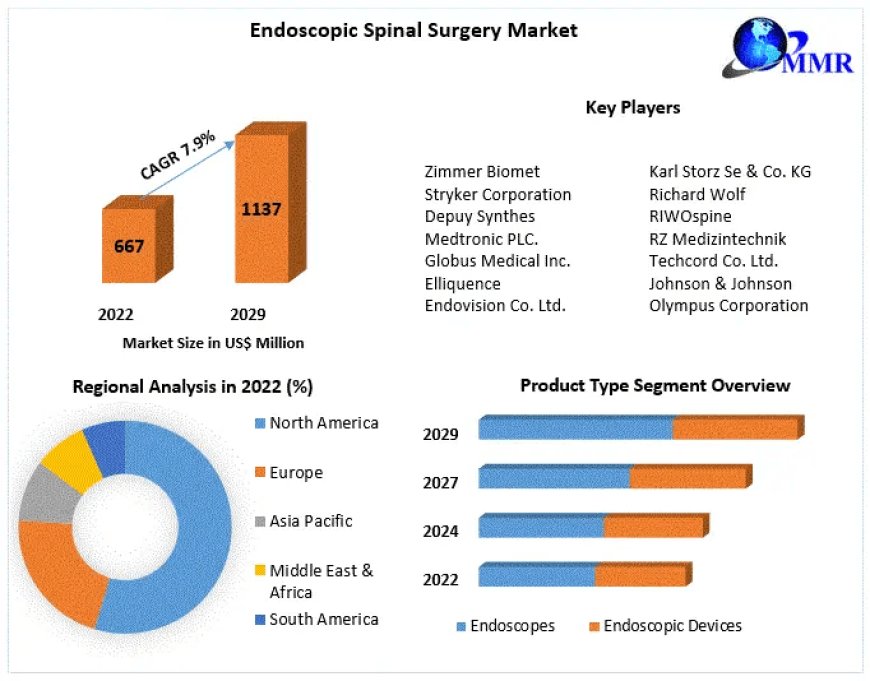 Endoscopic Spinal Surgery Market Global Trends, Market Share, Industry Size, Growth, Sales, Opportunities, and Market Forecast | 2029