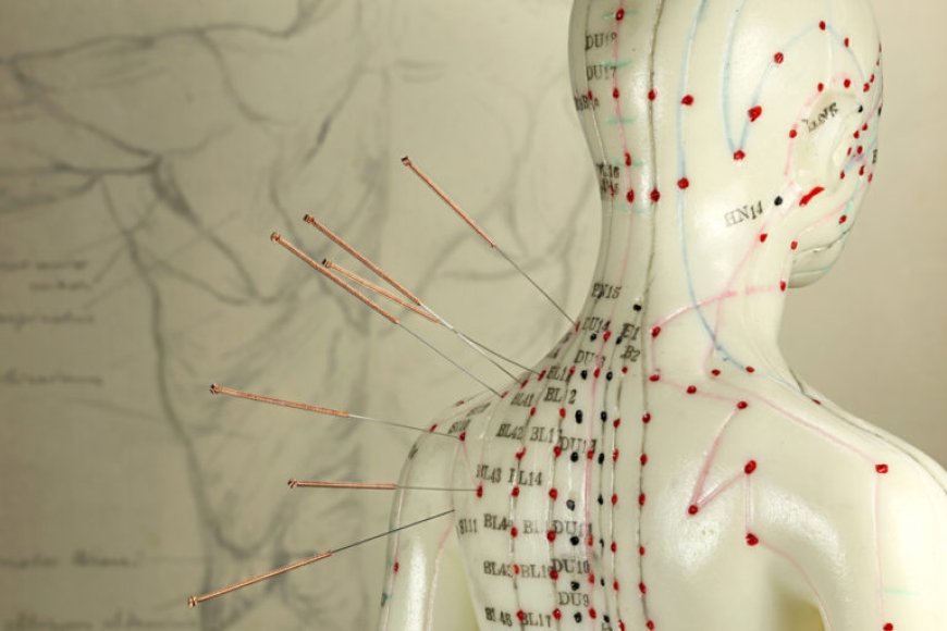 Finding The Best Traditional Chinese Acupuncture Clinic Near You