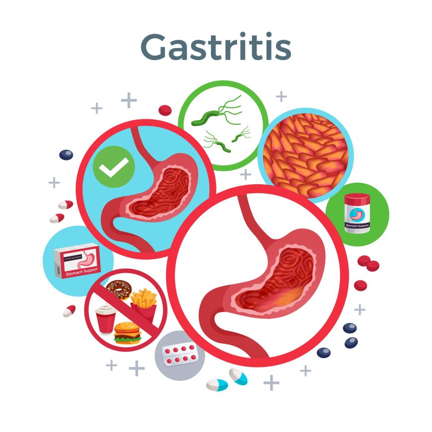 The Digestive Power of Bile Acid Metabolites