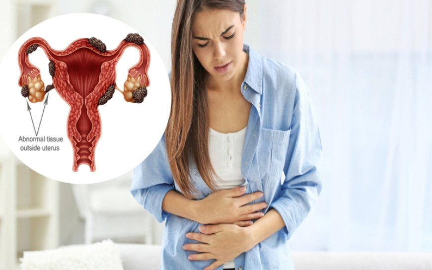 6 Common Signs of Endometriosis