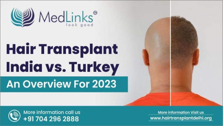 Hair Transplant: India vs. Turkey - A Comparative Analysis for 2023