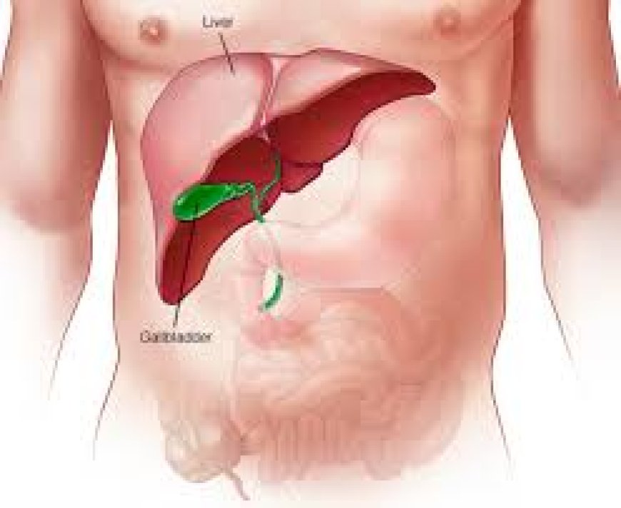 Comprehensive Guide to Finding the Best Gall Bladder Surgery Doctor in Ghatkopar