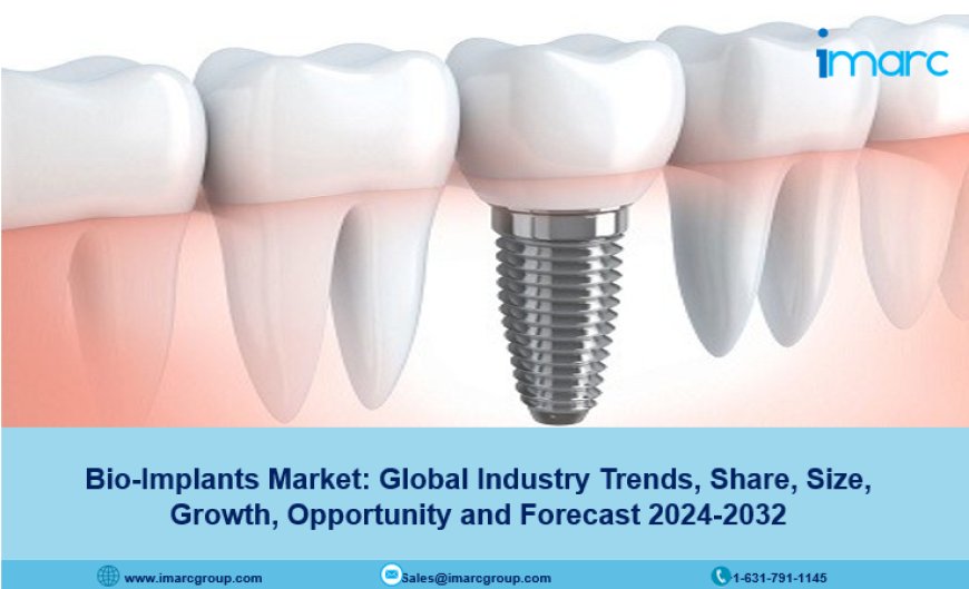 Bio-Implants Market 2024-2032 : Trends, Growth, Trends and Opportunity