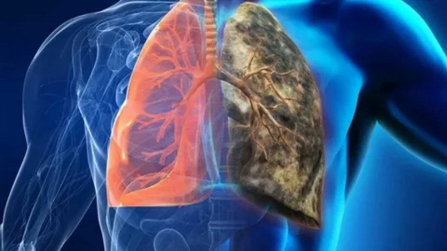 Lung Cancer Market Growth by Regional Segments 2024: Upcoming Business Strategies and Industry Revenue Forecast by 2032