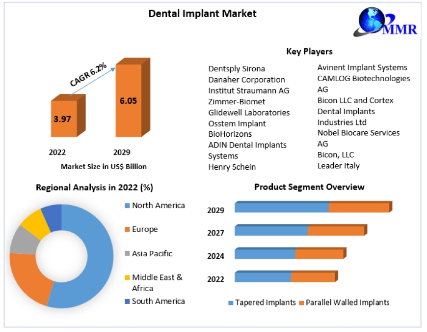 Dental Implant Market Size, Share, Opportunities, Revenue, Future Scope and Forecast 2030